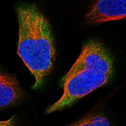 C11orf45 Antibody, Novus Biologicals:Antibodies:Primary Antibodies
